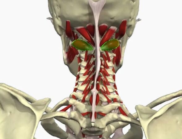 Синдром на Vail Artery
